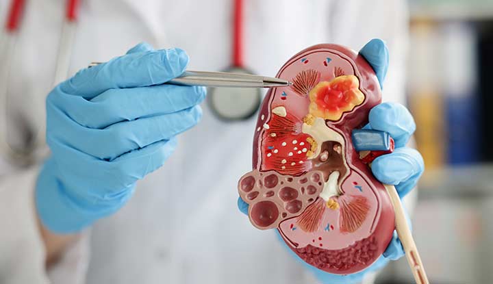 NEPHROLOGY