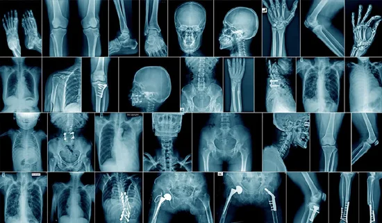 RADIODIAGNOSIS